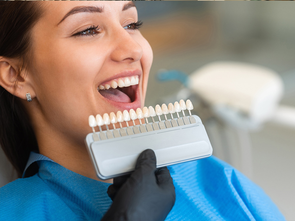 Tandheelkundige diensten tanden bleken